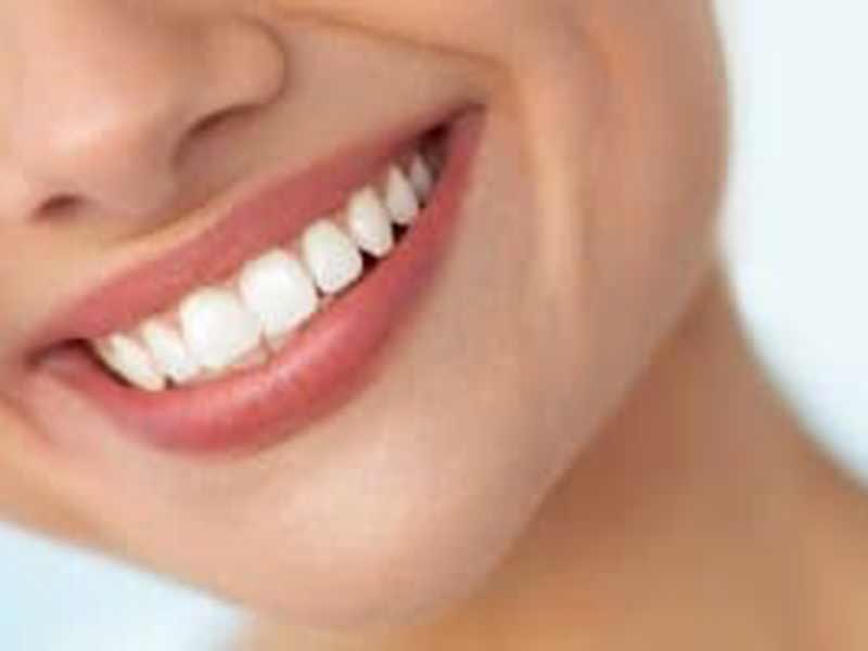 5 Benefits of Invisalign featured image