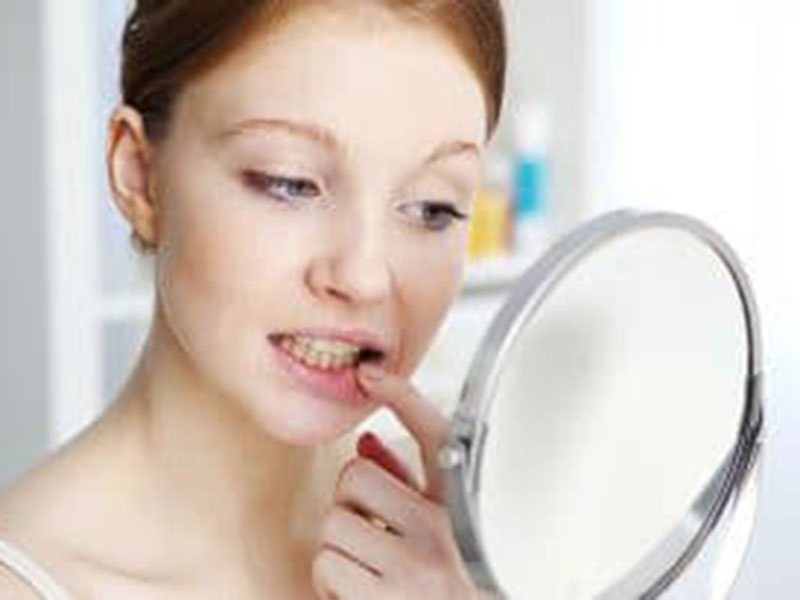 How to Tell if You Need Periodontal Treatment featured image