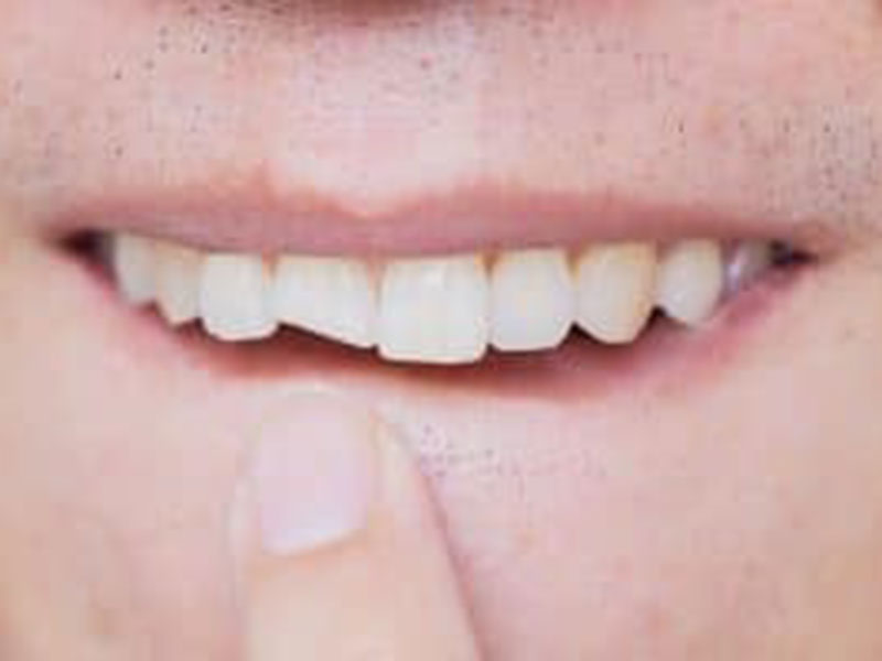 a person showing his teeth
