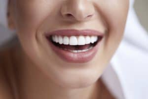 A Women showing her teeths