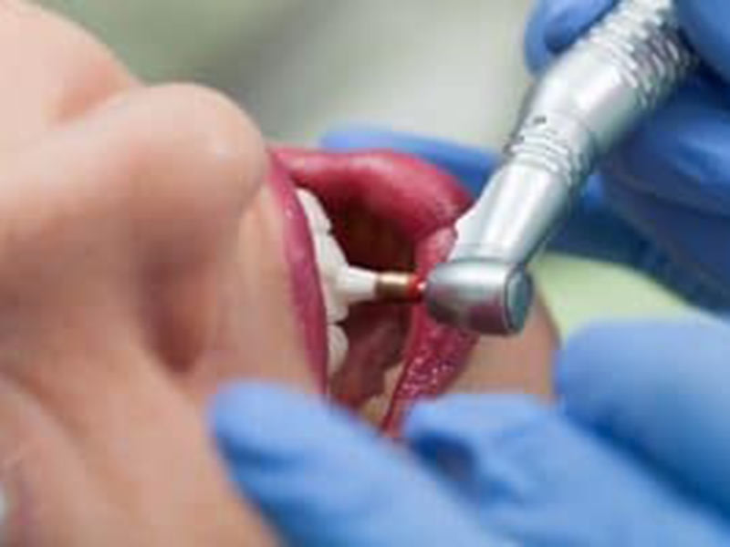 How Does a Cleaning Help Prevent Gum Disease? featured image