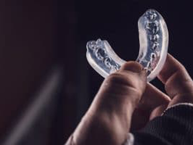 How We Protect Smiles With Custom Mouthguards featured image