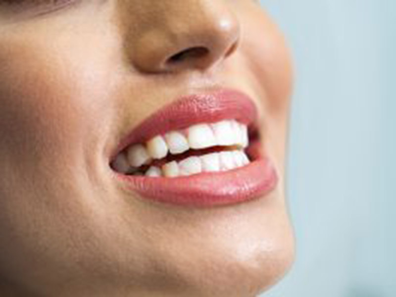 Improve Your Smile With a Cleaning featured image