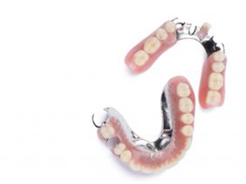 What Kind of Denture Will You Need? featured image