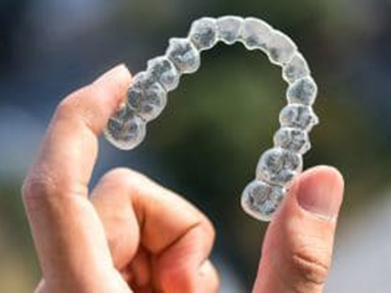 A Free Consultation for Clear Braces featured image