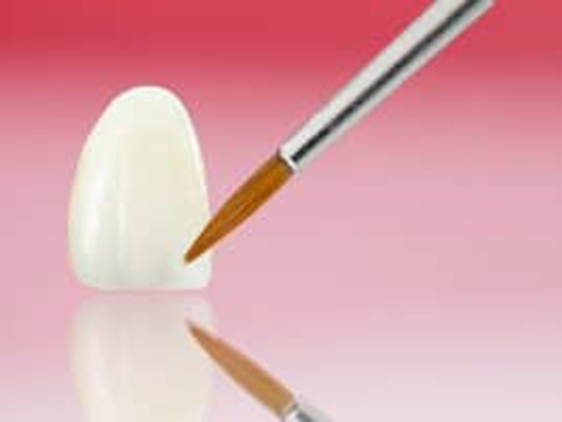 Creating Veneers to Transform Your Smile featured image