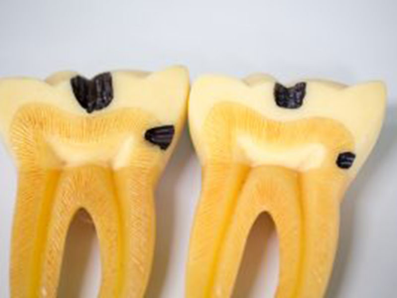 damaged artificial teeth