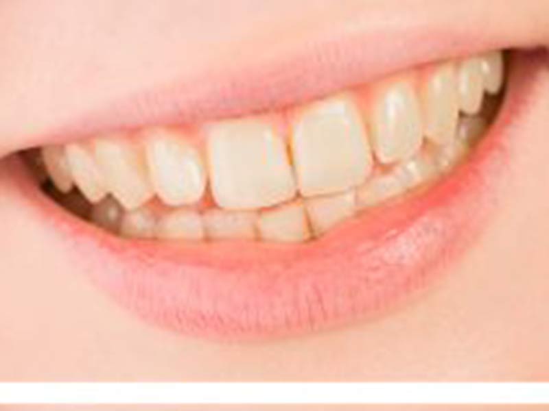 Our Teeth Whitening Selections featured image