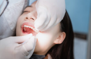 Saving Your Smile With a Tooth Extraction featured image