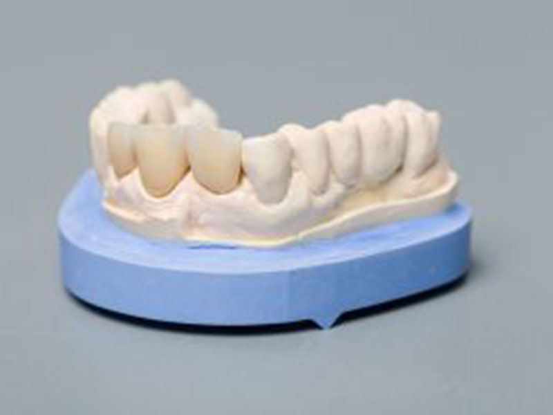 teeth made of clay