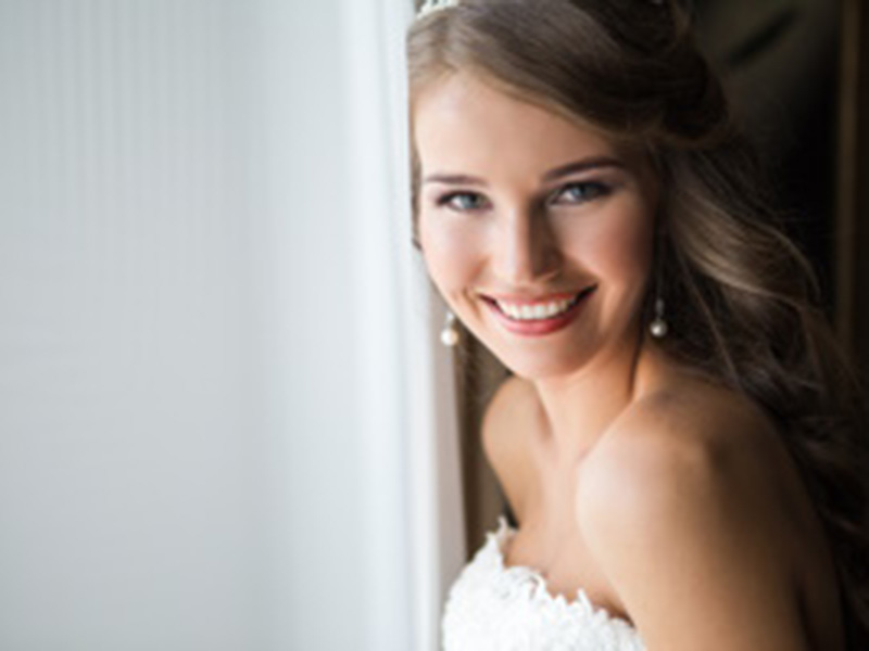 Get Ready for Wedding Season With Cosmetic Dentistry Services featured image