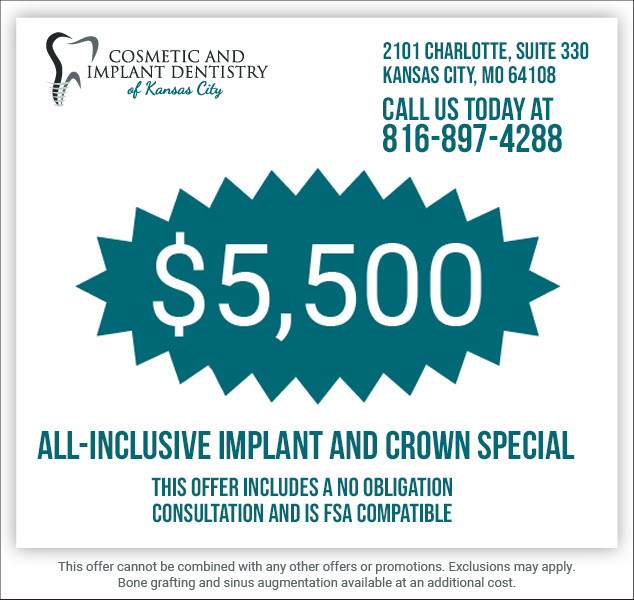 a $5,500 all-inclusive implant and crown special flier for Cosmetic and Implant Dentistry of Kansas City